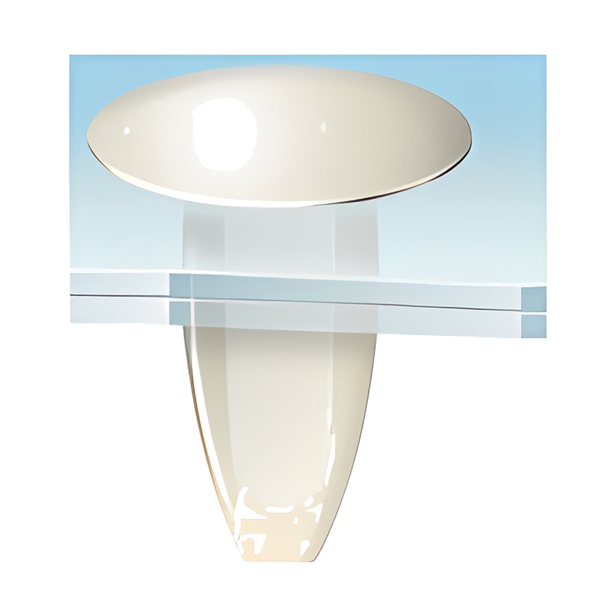 BRT 2092 Plastik Klips Perçin